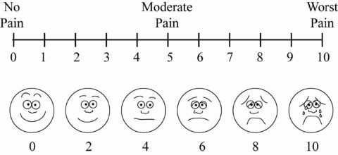 a VAS example of pain scale